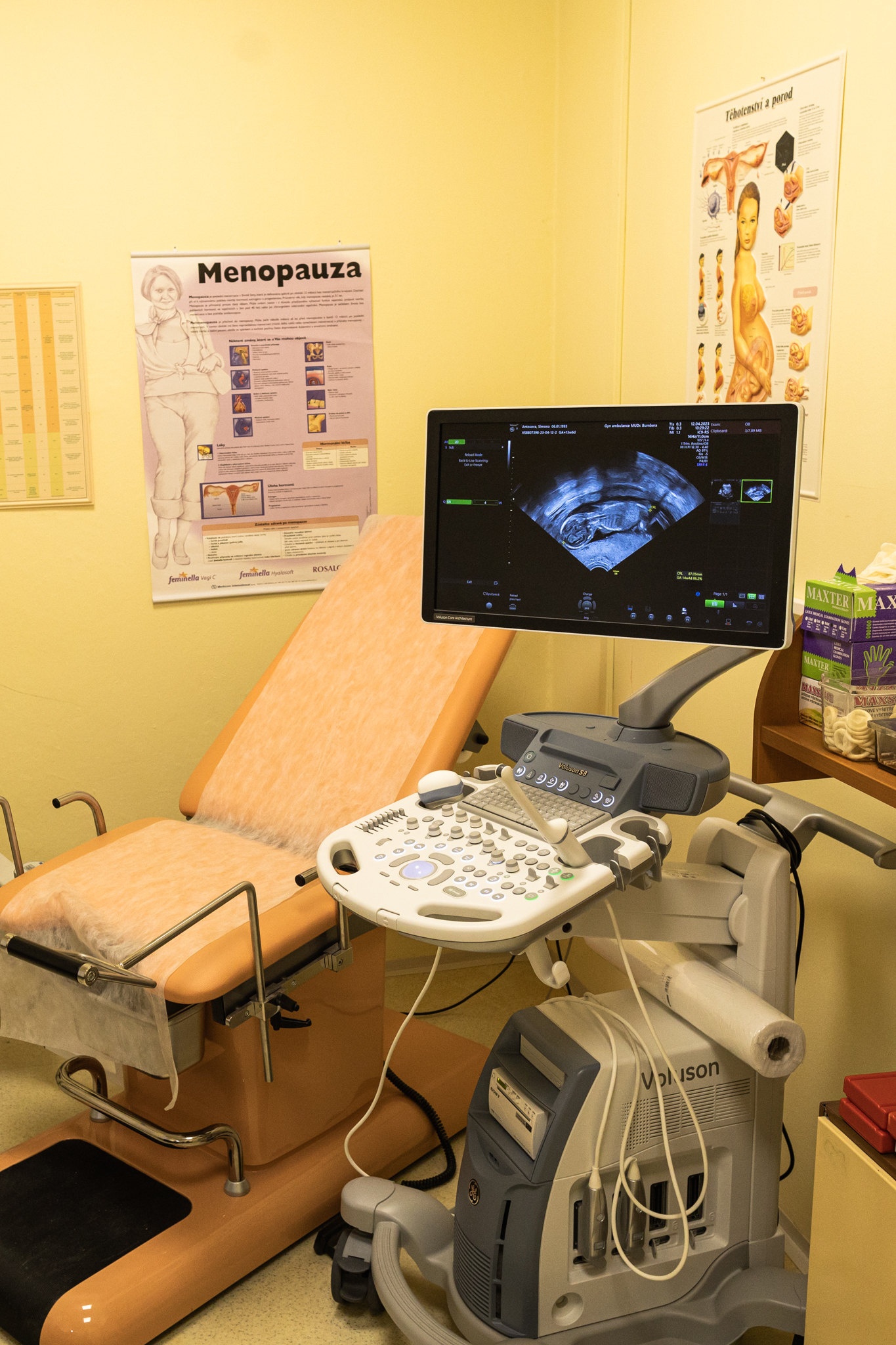 Ultrazvukový přístroj Voluson S8